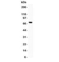 Western blot testing of Estrogen Receptor antibody and MCF-7 lysate (human breast tumor cell line). Predicted molecular weight ~67 kDa.