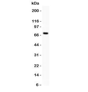Western blot testing of Estrogen Receptor antibody and MCF-7 lysate (human breast tumor cell line). Predicted molecular weight ~67 kDa.