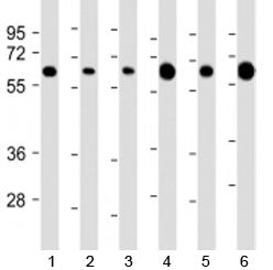 Western blot testing of 1) human HeLa, 2) human Jurkat, 3) human HepG2, 4) human liver, 5) mouse brain and 6) mouse heart lysate with PGM1 antibody at 1:2000. Predicted molecular weight: 61 kDa.