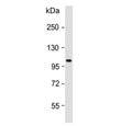 Western blot testing of human skeletal muscle lysate with ATP1A2 antibody. Predicted molecular weight ~112 kDa.