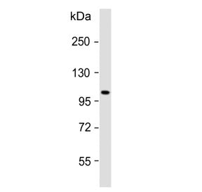 Western blot testing of human skeletal muscle lysate with ATP1A2 antibody. Predicted molecular weight ~112 kDa.