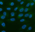 Immunofluorescent staining of ALOX5AP using anti-ALOX5AP antibody (green). ALOX5AP was detected in an immunocytochemical section of U2OS cells. Enzyme antigen retrieval was performed using IHC enzyme antigen retrieval reagent for 15 mins. The cells were blocked with 10% goat serum. And then incubated with 5 ug/ml rabbit anti-ALOX5AP antibody overnight at 4oC. DyLight 488 Conjugated Goat Anti-Rabbit IgG was used as secondary antibody at 1:500 dilution and incubated for 30 min at 37oC.