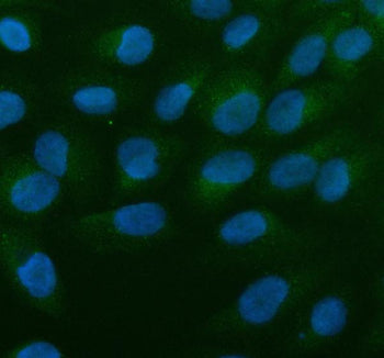 Immunofluorescent staining of ALOX5AP using anti-ALOX5AP antibody (green). ALOX5AP was detected in an immunocytochemical section of U2OS cells. Enzyme antigen retrieval was performed using IHC enzyme antigen retrieval reagent for 15 mins. The cells were blocked with 10% goat serum. And then incubated with 5 ug/ml rabbit anti-ALOX5AP antibody overnight at 4oC. DyLight 488 Conjugated Goat Anti-Rabbit IgG was used as secondary antibody at 1:500 dilution and incubated for 30 min at 37oC.