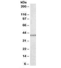 Western blot testing of rat kidney lysate with SUV39H2 antibody at 1ug/ml. Expected molecular weight: 40-53 kDa.