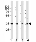 Western blot analysis of lysate from (1) human HeLa cell line, (2) mouse spleen, (3) rat lung, (4) rat stomach tissue using Cyclin D3 antibody at 1:1000. Predicted molecular weight ~33 kDa.