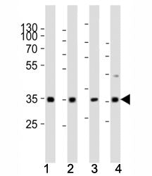 Western blot analysis of lysate from (1) human HeLa cell line, (2) mouse spleen, (3) rat lung, (4) rat stomach tissue using Cyclin D3 antibody at 1:1000. Predicted molecular weight ~33 kDa.