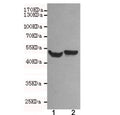 Western blot testing of 1) rat brain and 2) mouse brain lysates using NSE antibody at 1:500. Predicted molecular weight ~47 kDa.