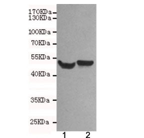Western blot testing of 1) rat brain and 2) mouse brain lysates using NSE antibody at 1:500. Predicted molecular weight ~47 kDa.