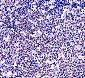 BAFF antibody immunohsitochemistry analysis in formalin fixed and paraffin embedded human tonsil tissue.
