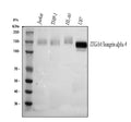 Western blot analysis of Integrin Alpha 4/ITGA4 using anti-ITGA4 antibody. Lane 1: human Jurkat whole cell lysates, Lane 2: human THP-1 whole cell lysates, Lane 3: human HL-60 whole cell lysates, Lane 4: human U87 whole cell lysates. After electrophoresis, proteins were transferred to a nitrocellulose membrane at 150 mA for 50-90 min. Blocked the membrane with 5% non-fat milk/TBS for 1.5 hour at RT.
