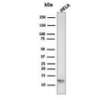 Western blot analysis of HeLa cell lysate using S100A4 antibody (clone S100A4/6799). Predicted molecular weight ~12 kDa.