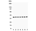 Western blot testing of RACK1 antibody and Lane 1: mouse liver; 2: rat spleen; 3: (m) spleen; 4: human SMMC-7721; 5: (h) HEPG2; 6: (m) HEPA; 7: (r) RH35 lysate. Predicted molecular weight: ~35 kDa.