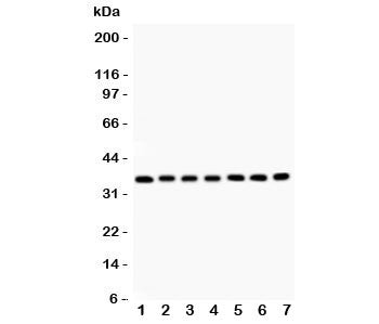 Western blot testing of RACK1 antibody and Lane 1: mouse liver; 2: rat spleen; 3: (m) spleen; 4: human SMMC-7721; 5: (h) HEPG2; 6: (m) HEPA; 7: (r) RH35 lysate. Predicted molecular weight: ~35 kDa.