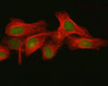 Immunofluorescent staining of FFPE human HeLa cells with FBXO32 antibody (green) and Beta Tubulin mAb (red). HIER: steam section in pH6 citrate buffer for 20 min.