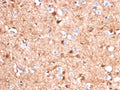 IHC staining of FFPE human cerebellum tissue with S100B antibody (clone S100B/4140). HIER: boil tissue sections in pH 9 10mM Tris with 1mM EDTA for 20 min and allow to cool before testing.