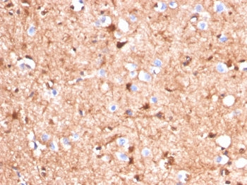IHC staining of FFPE human cerebellum tissue with S100B antibody (clone S100B/4140). HIER: boil tissue sections in pH 9 10mM Tris with 1mM EDTA for 20 min and allow to cool before testing.