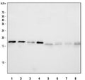 Western blot testing of 1) rat brain, 2) rat liver, 3) rat lung, 4) rat C6, 5) mouse brain, 6) mouse liver, 7) mouse lung and 8) mouse NIH 3T3 cell lysate with NM23 antibody. Expected molecular weight: 17/20 kDa (NM23-H1A/-H1B).