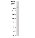 Western blot testing of human A431 cell lysate with P-Cadherin antibody (clone 6A9). Expected molecular weight: ~91 kDa (unmodified), 100~130 kDa (glycosylated).