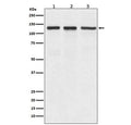 Western blot testing of 1) human A549, 2) mouse spleen and 3) rat brain lyaste with ITGAV antibody. Expected molecular weight: 116-150 kDa.