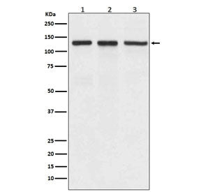 Western blot testing of 1) human A549, 2) mouse spleen and 3) rat brain lyaste with ITGAV antibody. Expected molecular weight: 116-150 kDa.