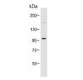 Western blot testing of human HT-1080 cell lysate with PI3K delta antibody. Expected molecular weight: 110-120 kDa.