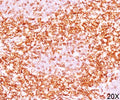 IHC testing of human tonsil (10X) stained with CD6 antibody (clone C6/372).