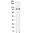 Western blot testing of 1) mouse testis and 2) human U-87 MG cell lysate with TACC1 antibody at 0.5ug/ml. Predicted molecular weight ~88 kDa but routinely observed at 100-125 kDa.