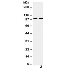 Western blot testing of 1) mouse testis and 2) human U-87 MG cell lysate with TACC1 antibody at 0.5ug/ml. Predicted molecular weight ~88 kDa but routinely observed at 100-125 kDa.