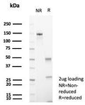 SDS-PAGE analysis of purified, BSA-free CD56 antibody (clone NCAM/7521) as confirmation of integrity and purity.