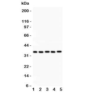 Western blot testing of HOXA11 antibody and Lane 1: rat brain; 2: human placenta; 3: human HeLa; 4: (h) HT1080; 5: mouse HEPA lysate. Expected molecular weight: ~35 kDa.