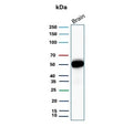 Western blot testing of human brain tissue with GFAP antibody. Predicted molecular weight ~50 kDa.