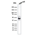 Western blot testing of MBP-tagged recombinant protein with MBP tag antibody.