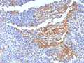 IHC staining of FFPE human tonsil tissue with CD14 antibody (clone LPSR/7738). HIER: boil tissue sections in pH 9 10mM Tris with 1mM EDTA for 20 min and allow to cool before testing.
