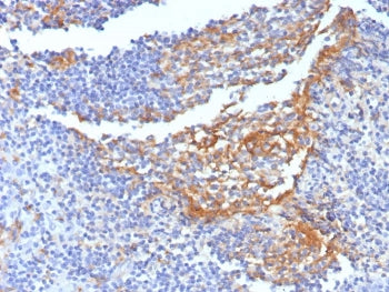 IHC staining of FFPE human tonsil tissue with CD14 antibody (clone LPSR/7738). HIER: boil tissue sections in pH 9 10mM Tris with 1mM EDTA for 20 min and allow to cool before testing.