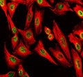 Immunofluorescent staining of POLD1 using anti-POLD1 antibody (green) and anti-Beta Tubulin antibody (red). POLD1 was detected in an immunocytochemical section of U2OS cells. Enzyme antigen retrieval was performed using IHC enzyme antigen retrieval reagent for 15 mins. The cells were blocked with 10% goat serum. And then incubated with 5 ug/ml rabbit anti-POLD1 antibody and mouse anti-Beta Tubulin antibody overnight at 4oC.