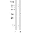 Western blot testing of human 1) A431 and 2) Jurkat cell lysate with CAPZA1 antibody. Predicted molecular weight ~33 kDa.