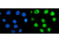Immunofluorescent staining of FFPE human MCF7 cells with PSMC3 antibody (green) and DAPI nuclear stain (blue). HIER: steam section in pH6 citrate buffer for 20 min.