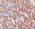 IHC testing of formalin-fixed, paraffin-embedded human tonsil with SUMO-2 antibody (clone S2MT-1). Required HIER: boil tissue sections in pH 9 10mM Tris with 1mM EDTA for 10-20 min.