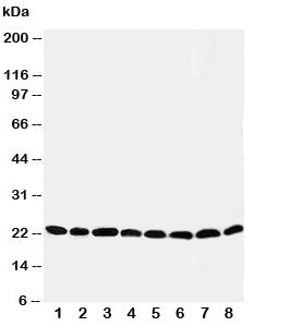 Western blot testing of Peroxiredoxin 5 antibody and Lane 1: rat brain; 2: (r) lung; 3: (r) liver; 4: (r) kidney; 5: human HeLa; 6: (h) 293T; 7: (h) MCF-7; 8: (h) A549 cell lysate. Expected size: ~22KD