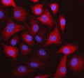 Immunofluorescent staining of STOML3 using anti-STOML3 antibody. STOML3 was detected in an immunocytochemical section of cells. Enzyme antigen retrieval was performed using IHC enzyme antigen retrieval reagent for 15 mins. The cells were blocked with 10% goat serum. And then incubated with 5 ug/ml rabbit anti-STOML3 antibody overnight at 4oC. Cy3 Conjugated Goat Anti-Rabbit IgG was used as secondary antibody at 1:500 dilution and incubated for 30 min at 37oC.