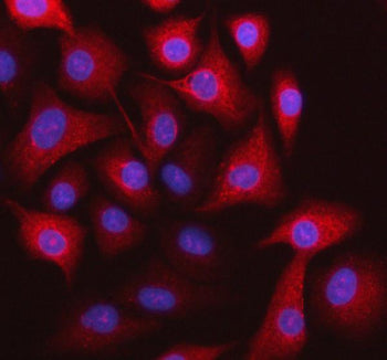 Immunofluorescent staining of STOML3 using anti-STOML3 antibody. STOML3 was detected in an immunocytochemical section of cells. Enzyme antigen retrieval was performed using IHC enzyme antigen retrieval reagent for 15 mins. The cells were blocked with 10% goat serum. And then incubated with 5 ug/ml rabbit anti-STOML3 antibody overnight at 4oC. Cy3 Conjugated Goat Anti-Rabbit IgG was used as secondary antibody at 1:500 dilution and incubated for 30 min at 37oC.