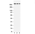 Western blot testing of LAMA2 antibody and Lane 1: HeLa; 2: A549; 3: PANC lysate. Predicted molecular weight ~344 kDa.