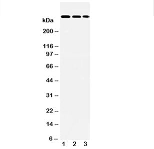 Western blot testing of LAMA2 antibody and Lane 1: HeLa; 2: A549; 3: PANC lysate. Predicted molecular weight ~344 kDa.