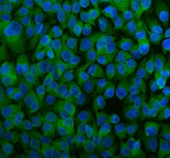Immunofluorescent staining of FFPE human SK-O-V3 cells with DJ-1 antibody (green) and DAPI nuclear stain (blue). HIER: steam section in pH6 citrate buffer for 20 min.
