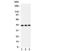 Western blot testing of CCR9 antibody and Lane 1: Jurkat; 2: HeLa; 3: SMMC-7721 cell lysate. Expected/observed size ~43KD