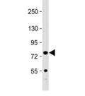 Western blot testing of mouse spleen lysate with Kindlin-3 antibody at 1:2000. Predicted molecular weight: 76 kDa.