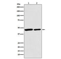Western blot testing of 1) human HeLa and 2) mouse spleen lysate with Citrate synthase antibody. Predicted molecular weight: 46-52 kDa.