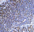 Immunohistochemical staining of NCF1 using anti- NCF1 antibody. NCF1 was detected in a paraffin-embedded section of mouse lymph tissue. Heat mediated antigen retrieval was performed in EDTA buffer (pH 8.0, epitope retrieval solution). The tissue section was blocked with 10% goat serum. The tissue section was then incubated with 2 ug/ml rabbit anti- NCF1 antibody overnight at 4oC. Peroxidase Conjugated Goat Anti-rabbit IgG was used as secondary antibody and incubated for 30 min at 37oC.