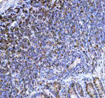 Immunohistochemical staining of NCF1 using anti- NCF1 antibody. NCF1 was detected in a paraffin-embedded section of mouse lymph tissue. Heat mediated antigen retrieval was performed in EDTA buffer (pH 8.0, epitope retrieval solution). The tissue section was blocked with 10% goat serum. The tissue section was then incubated with 2 ug/ml rabbit anti- NCF1 antibody overnight at 4oC. Peroxidase Conjugated Goat Anti-rabbit IgG was used as secondary antibody and incubated for 30 min at 37oC.