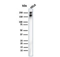 Western blot testing of human HeLa cell lysate with recombinant Spectrin beta III antibody. Predicted molecular weight ~246 kDa.